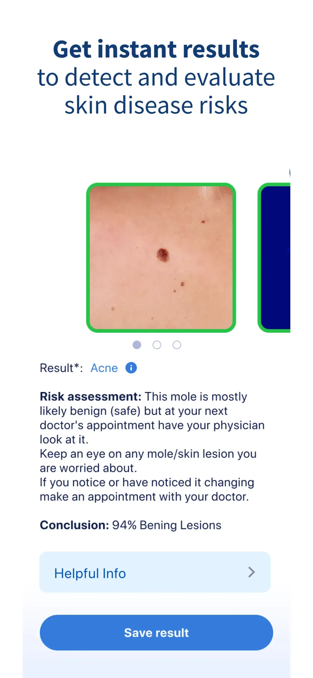 AI Dermatologist: Skin Scanner App Store screenshot 4