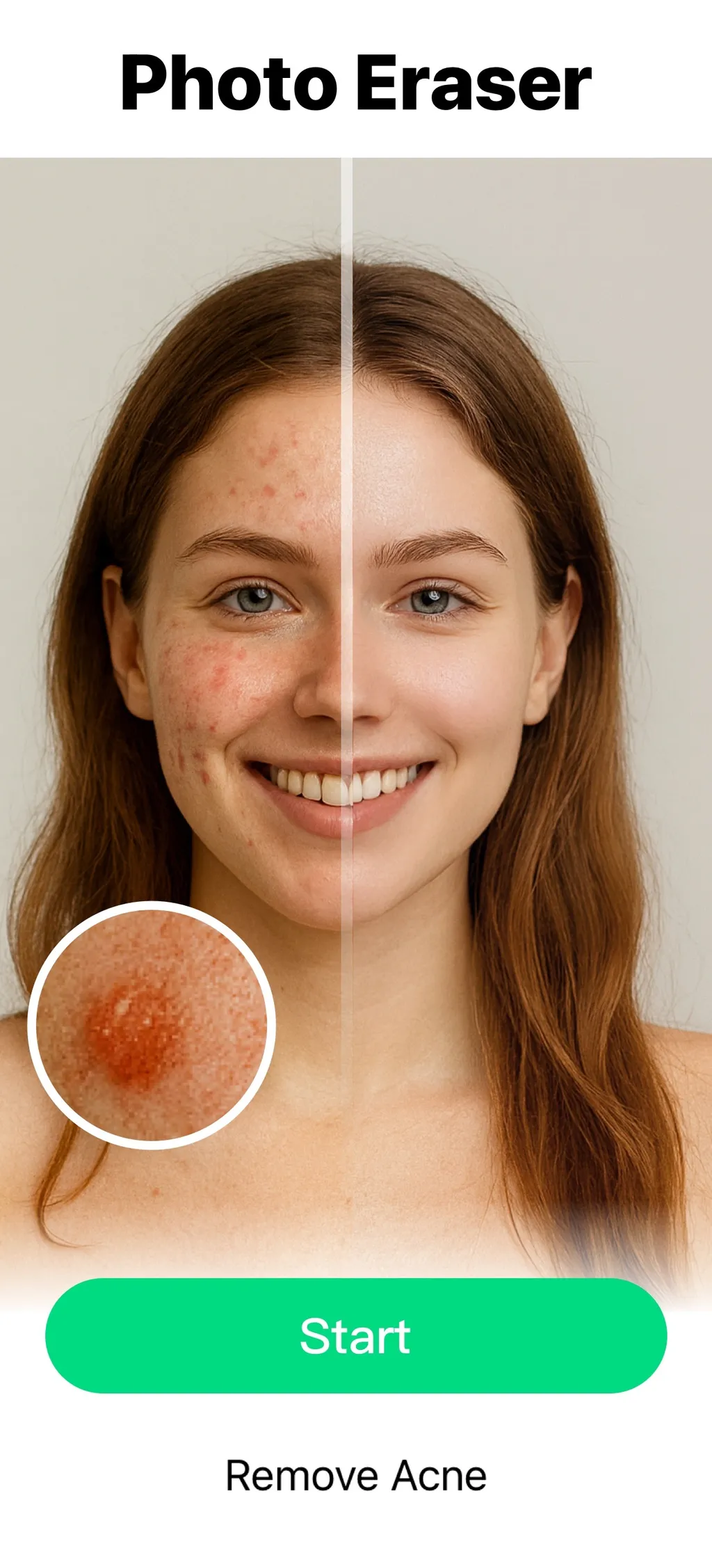 Object Removal AI - AI Retouch App Store screenshot 4